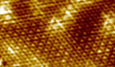 Interplay Between Charge Density Wave and Superconductivity in Transition Metal Dichalcogenides